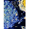 SCIENCES DE LA VIE ET DE LA TERRE 3E - LIVRE - SVT 3E - LIVRE